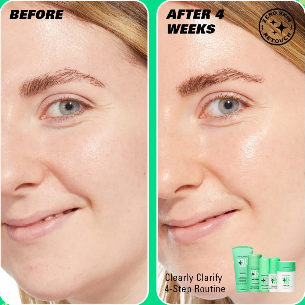 Revolution Beauty Revolution Skin Clearly Clarify 4 Step Starter Kit Minis^ Salicylic Acid|Niacinamide