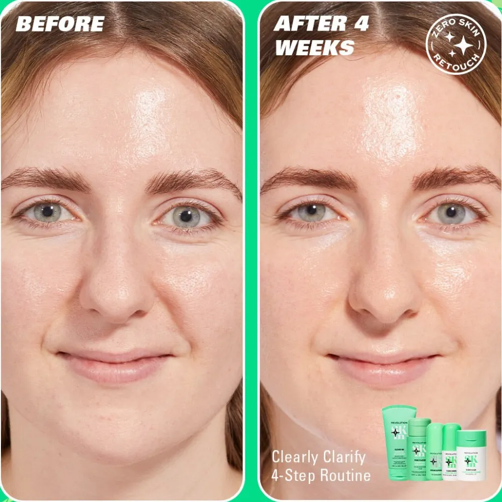 Revolution Beauty Revolution Skin Serum Supreme 10% Niacinamide Serum Clarifying Serum 30ml^ Niacinamide|Dark Spots & Hyperpigmentation